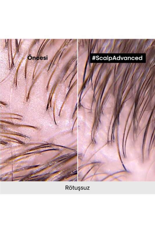 LOréal Professionnel Serie Expert Scalp Advanced Yağlanma Karşıtı ve Saç Derisi Dengeleyici Şampuan 500 ml - Sebum Kontrol & Hacim Artışı - 8