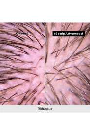 LOréal Professionnel Scalp Advanced Hassas Saç Derisi Bakım Şampuanı - Kaşıntı Önleyici, Hacim Artıran & Nem Dengeleyici 500 ml - 8