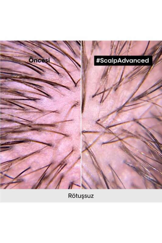 LOréal Professionnel Scalp Advanced Hassas Saç Derisi Bakım Şampuanı - Kaşıntı Önleyici, Hacim Artıran & Nem Dengeleyici 500 ml - 8
