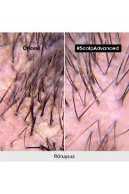 LOréal Professionnel Scalp Advanced Kepek Önleyici Şampuan - Saç Derisi Kaşıntı ve Pullanma Kontrolü 500 ml - 6